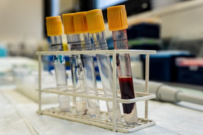 03AUG20 Blood samples in test tube rack vials
