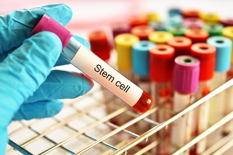 03AUG20 Blood vial containing stem cells