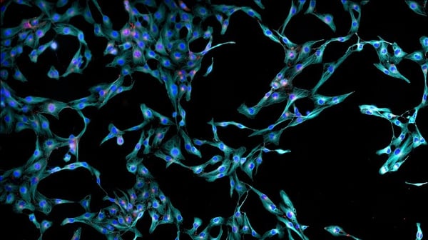 Fibroblasts microscopy cells stained-1