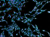 03AUG20 Fibroblasts microscopy cells stained-3