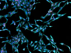 03AUG20 Fibroblasts microscopy cells stained-3