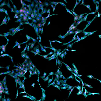 03AUG20 Fibroblasts microscopy cells stained-Aug-12-2021-02-24-59-57-PM
