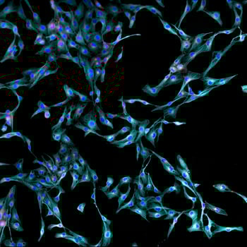 03AUG20 Fibroblasts microscopy cells stained-Aug-12-2021-02-24-59-57-PM