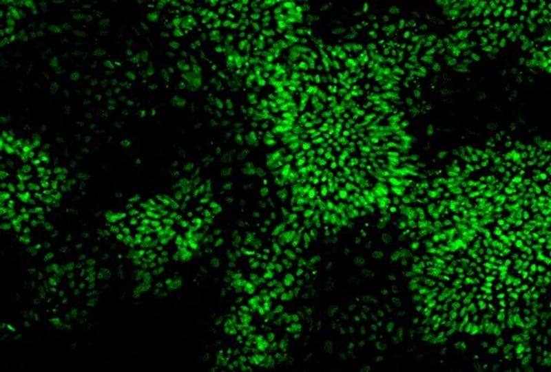 05MAR21 NSCs from REPROCELL Biobank in GFP