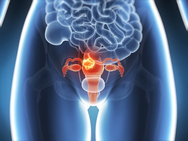 07AUG20 human uterus female reproductive system organ-3