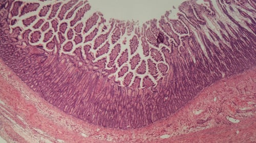 07AUG20 ibd colitis intestine histology microscopy-1