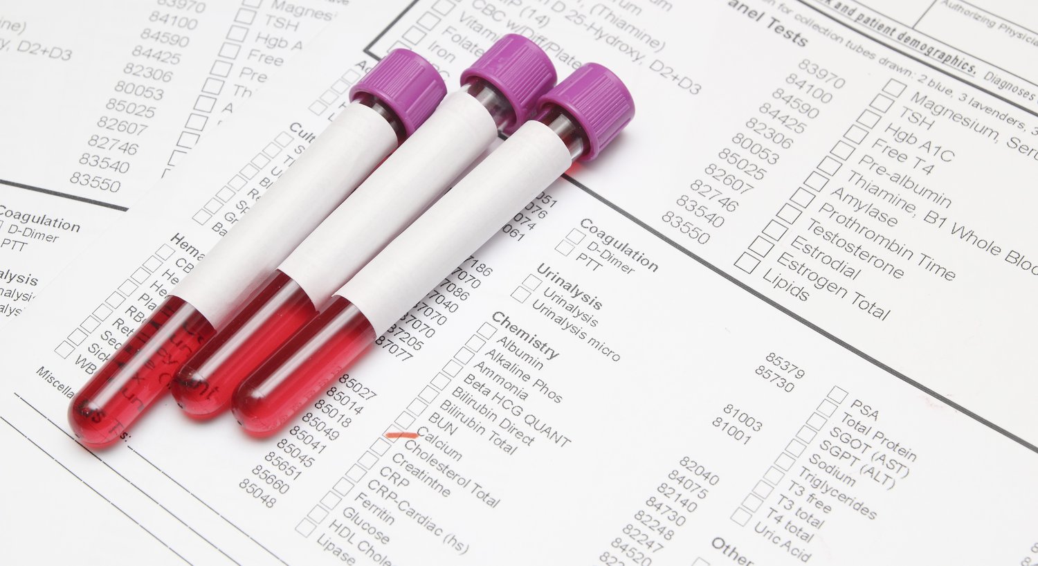 14NOV19 Blood sample stock image-1-1