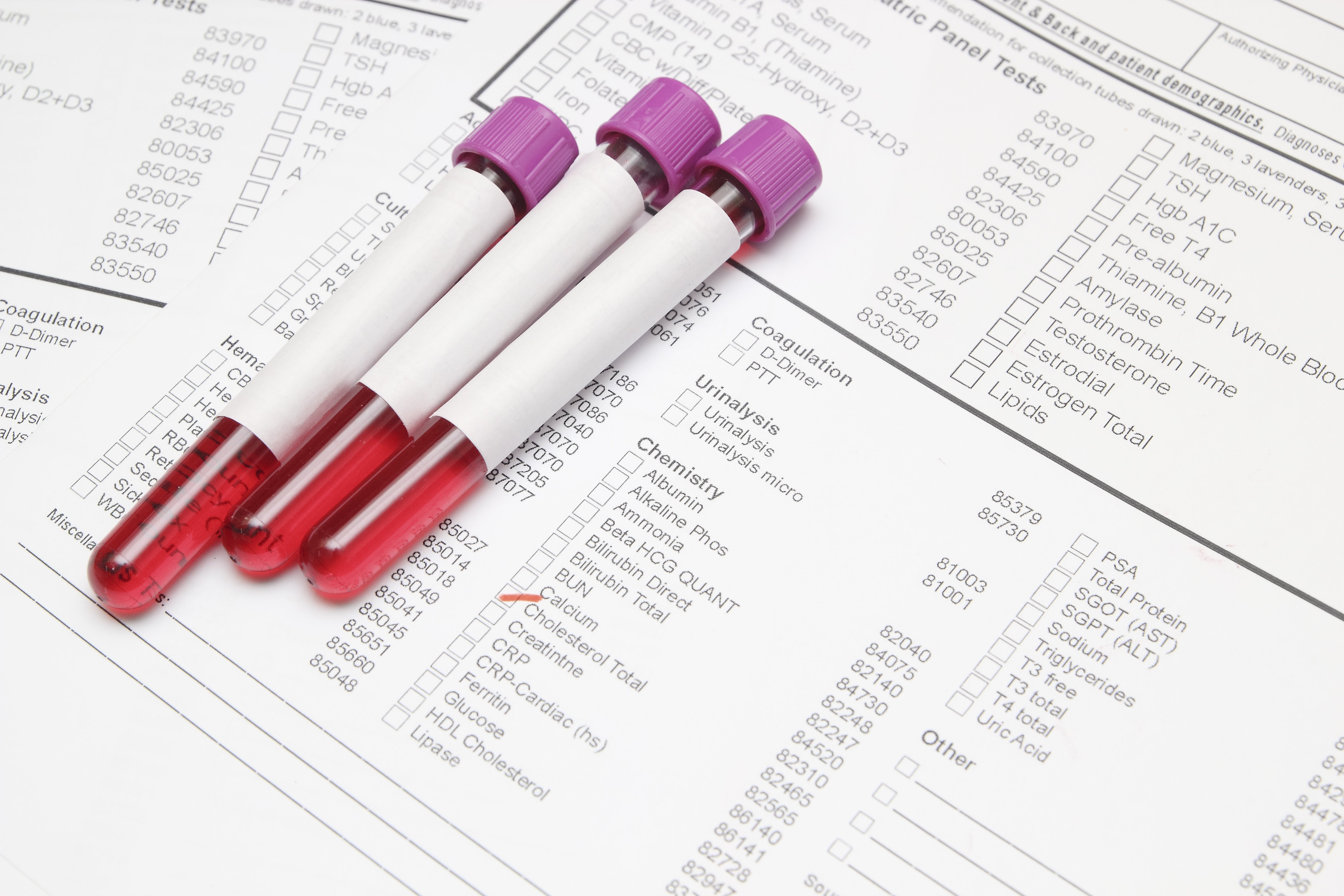 14NOV19 Blood sample stock image-1