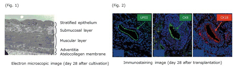 1536919125permeable-membrane-t1-01