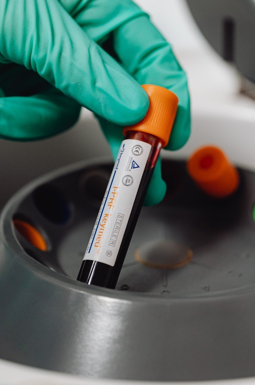 Protocol for PBMC isolation from buffy coat samples