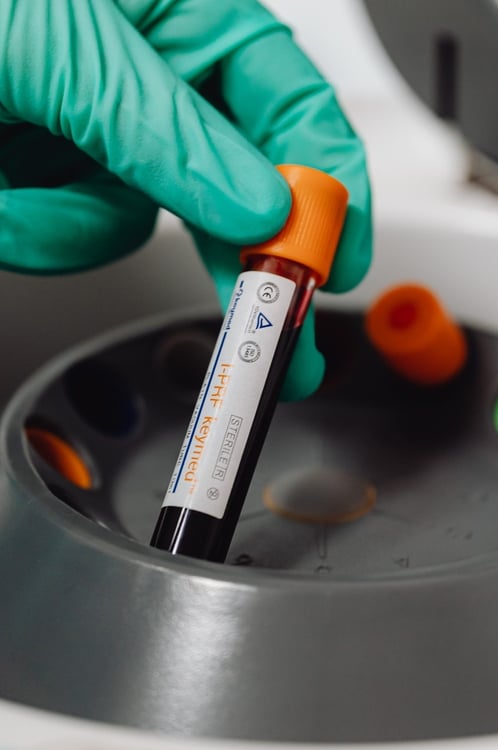 17JAN22 Blood centrifuge PBMC -1
