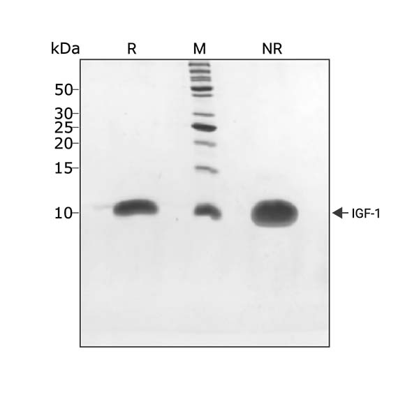 210826-SDS-PAGE-IGF-1-104331-3-ug