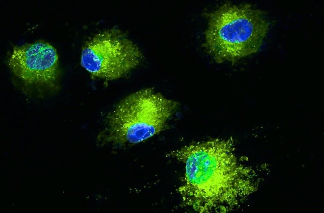 Mesenchymal stem cells Cells under fluorescent microscope