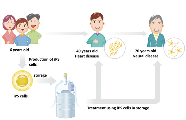 A diagram showing how personalized iPSCs can be created from a customer for use in later life-1