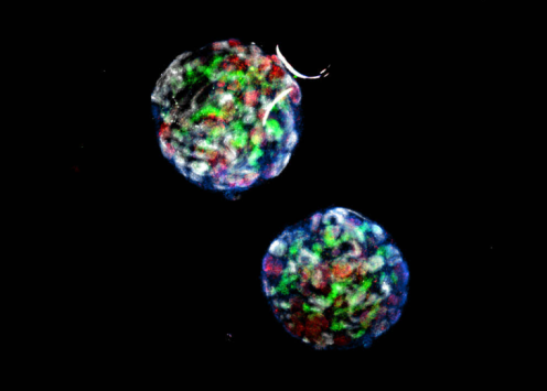 A microscopic image of renal organioids produced by Ryuji Morizane