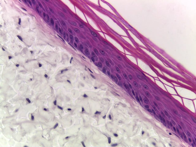 Alvetex Advanced bioengineered full thickness skin model