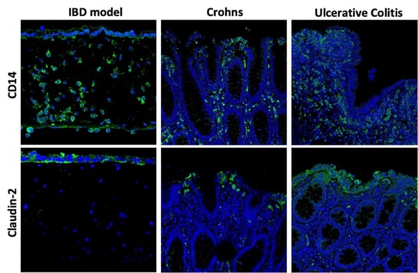 Alvetex IBD model vs Crohns and UC tissues