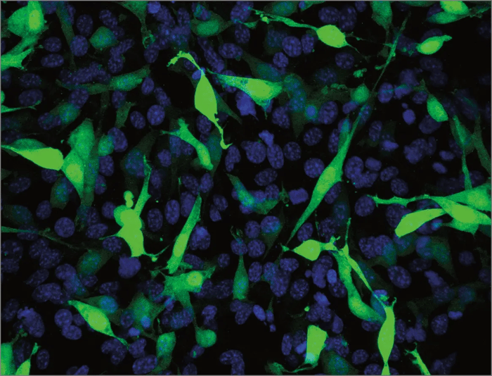 Alvetex Scaffold fibroblasts transfected with GFP