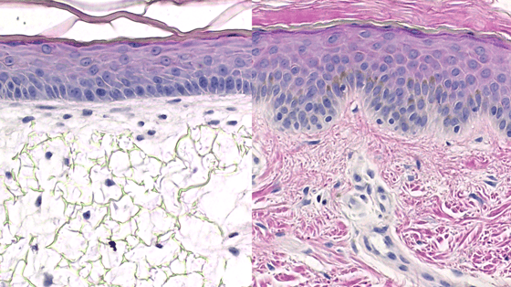 Alvetex skin model vs human skin