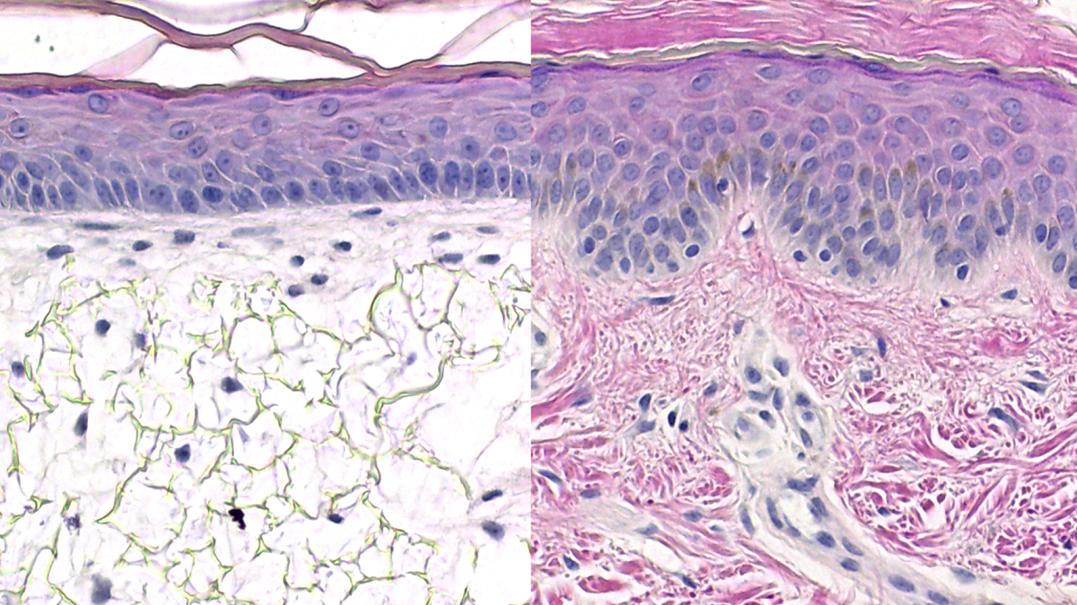 Comparison of In vivo human skin model to a in vitro human skin model 