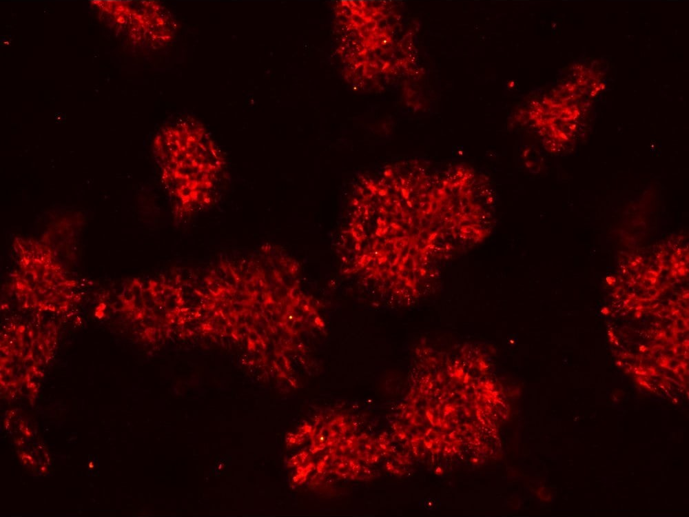 Anti-TRA-1-60 staining of iPSCs