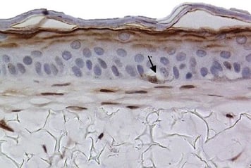 B Melnocytes s100-1