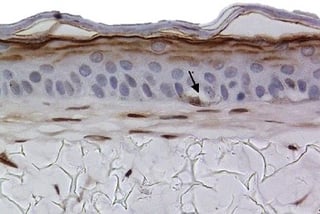B Melnocytes s100-1