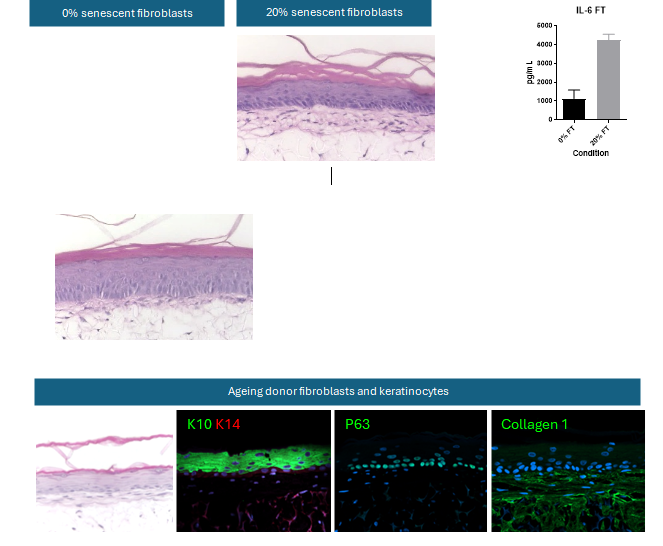 B128 - Models with increasing senescent cells display epidermal thinning and alterations in tissue morphology