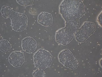 B2M KO iPSCs