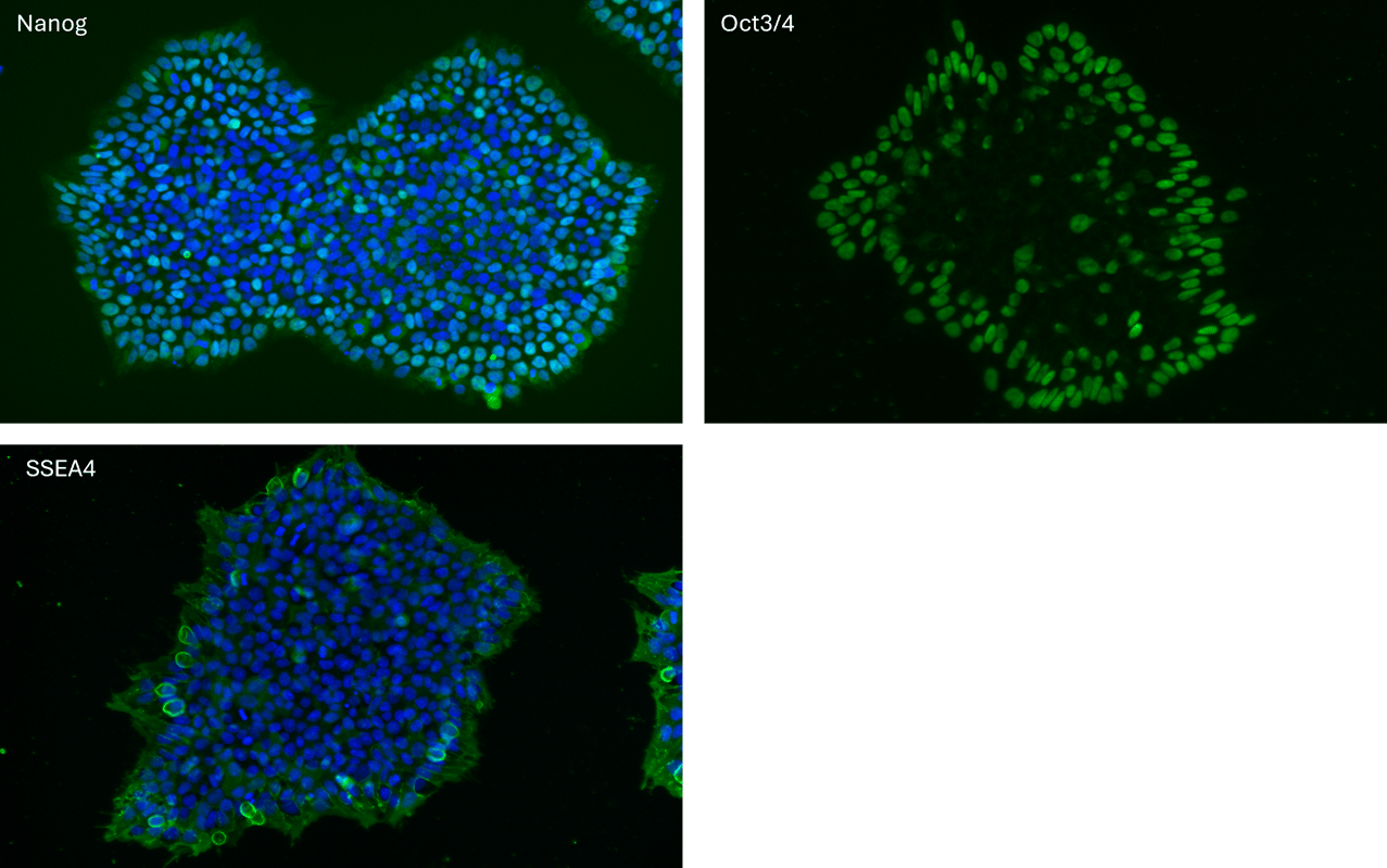 B2M KO pluripotency markers expression