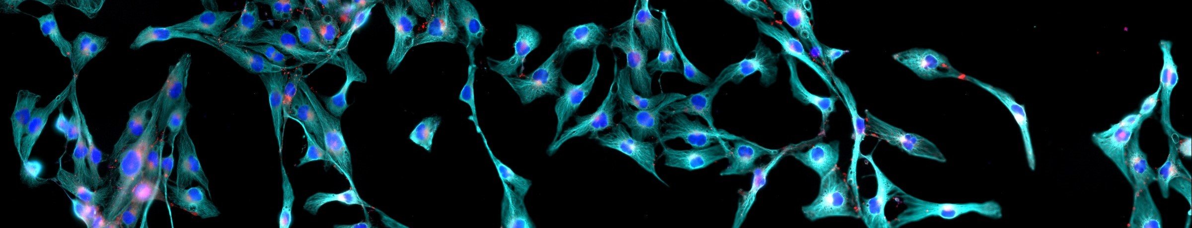 Bioserve Pillar Page picture Fibroblasts