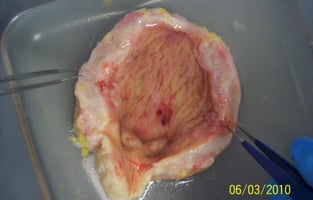 Bladder tissue 2