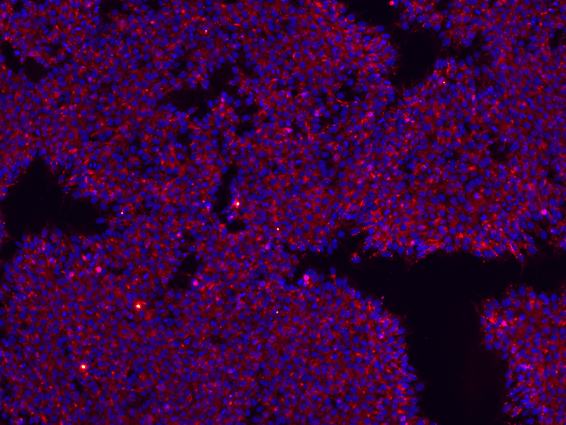 Editing B2M and CIITA to Create Hypoimmune Cell Lines for Cell Therapy