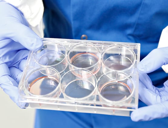 Image of a scientist holding a culture dish 