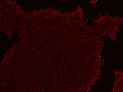 Stem cells stained for TRA-1-60 showing reduced fluorescence signal 