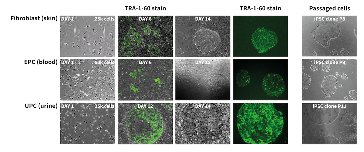 iPSC-reprogramming-timeline