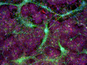 iPSCs-NutriStem-iMatrix-511-neuronal-cells