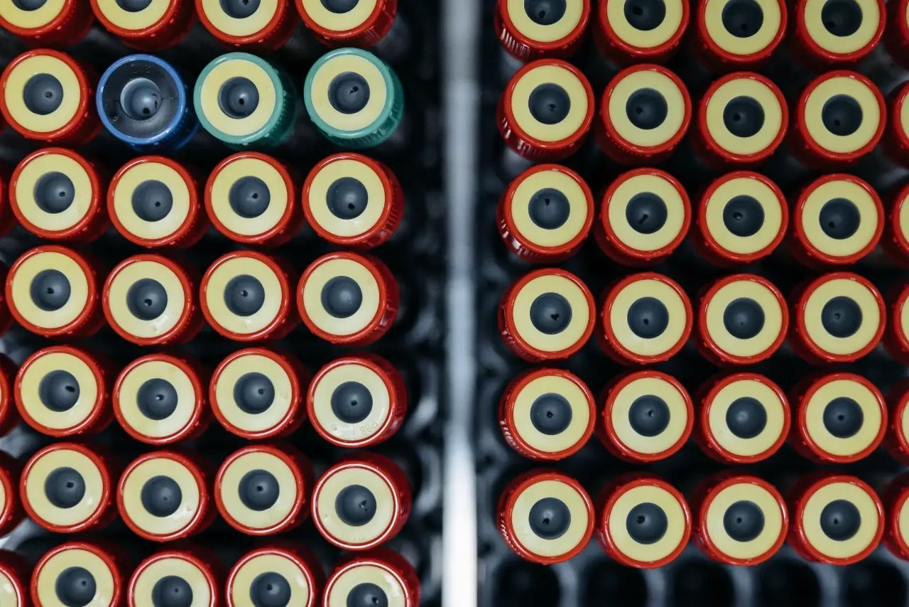 Blood sample tubes in racks