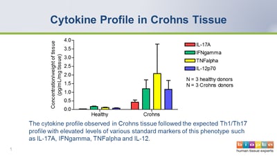 Beyond Anti-TNF: Advances in Targeted Therapies for Crohn’s Disease and Ulcerative Colitis