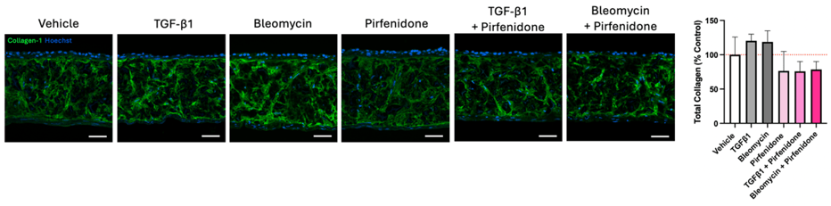 DD assay 130 - pirfenidone attenuates pro-fibrotic effects of TGF-β1 and bleomycin, and reduces total collagen content in IPF models