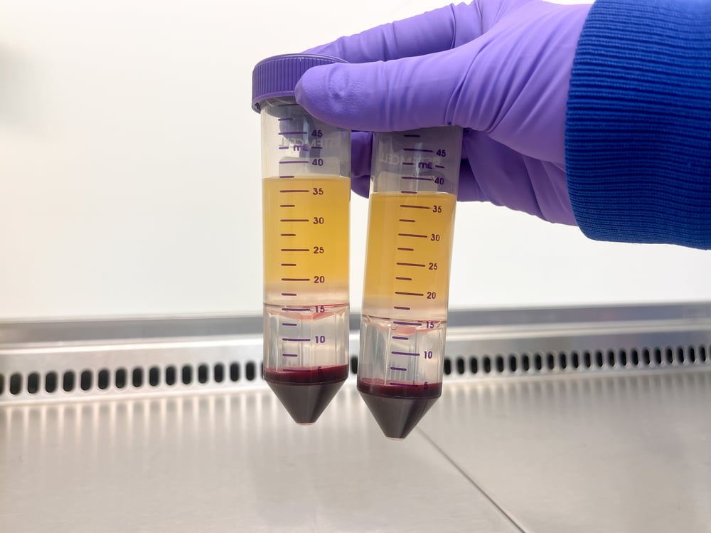 Density gradient centrifugation of whole blood