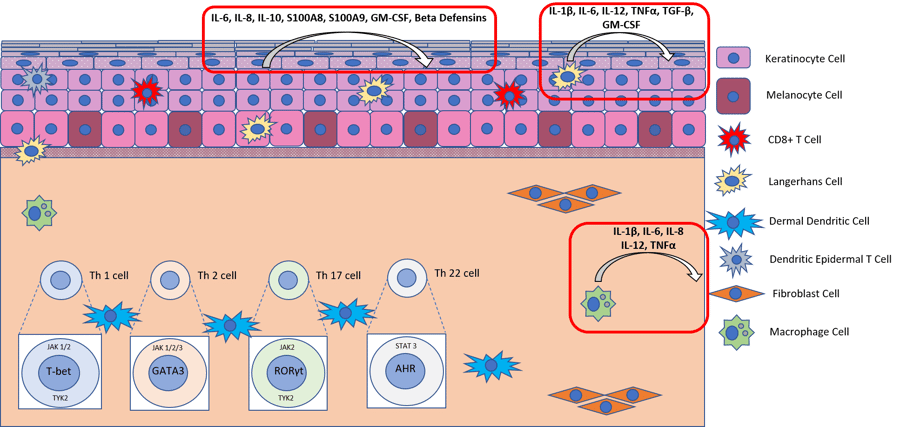 Diagram showing how topical application of LPS stimualtes an acen phenotype in human skin explants
