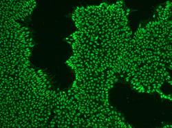 Double Staining 2_110SBMC5 B3 OCT4 SSEA4 5% X10 GFP_Crop001