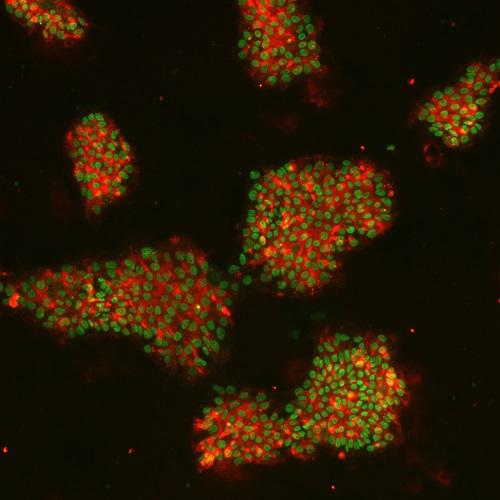 Double Staining 2_BT17110KMC13 A1 NANOG TRA160 1% X10 GFP 594-3