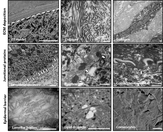 ECM of alvetex skin equivalent