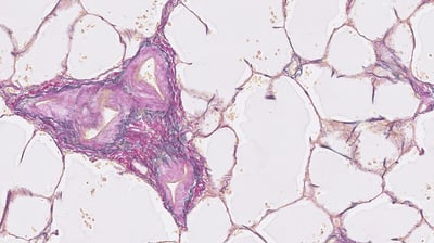 EVG Precision Cut Lung