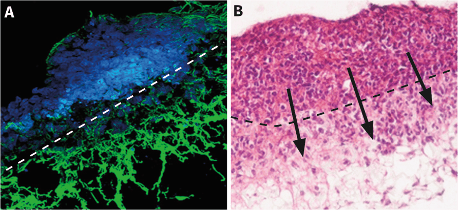 Examples of cells from tissue pieces placed on top of Alvetex Scaffold migrating into the structure of the scaffold