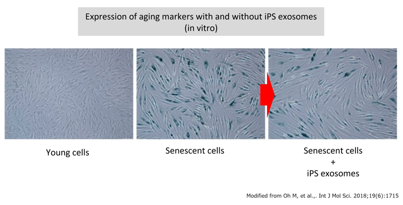 Expression of aging markers with and without iPS exosomes-png