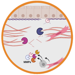 Fibrosis and Remodelling