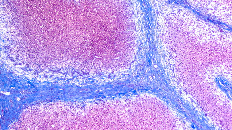 Modeling&nbsp;Fibrosis Progression Ex Vivo: Opportunities for Anti-Fibrotic Drug Screening